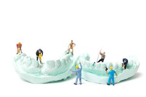 trabalhadores em miniatura obtendo dentes falsos e colocando-os em uma dentadura feita com gesso, conceito de laboratório de prótese dentária foto