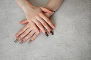 fêmea mãos fechar-se com regenerado quebrado unhas. falta do manicure em a mãos, preparado fêmea mãos foto