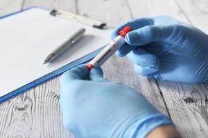 técnico de laboratório segurando tubo de ensaio de sangue foto