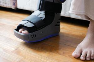 pés quebrados femininos com uma bota de plástico cinza protetor de tornozelo bota protetora foto