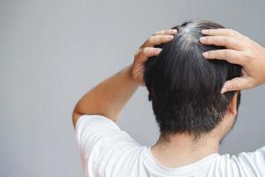 costas Visão do jovem pessoas prematuro cinzento cabelo, mostrando Preto velho cabelo raízes em cabeça mudança para Senior velho homem ar livre. foto