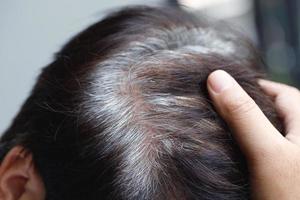 costas Visão do jovem pessoas prematuro cinzento cabelo, mostrando Preto velho cabelo raízes em cabeça mudança para Senior velho homem ar livre. foto