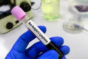 cientista aguarde sangue amostra para não-hodgkin linfoma teste. não hodgkin linfoma é uma tipo do Câncer do linfático sistema. foto