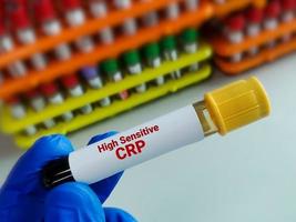 sangue amostra tubo para hs-crp ou Alto sensível crp teste, para a diagnóstico do inflamatório coração doença foto
