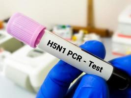 h5n1 gripe vírus triagem positivo sangue amostra para pcr teste para a confirmação do infecção. foto