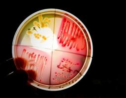 bactérias colônia em cultura meios de comunicação placa. bacteriano cultura teste. foto