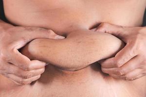 close-up de uma pessoa com excesso de gordura estomacal foto