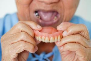 ásia Senior mulher paciente vestindo dentes dentadura para dentro dela boca para mastigar Comida. foto