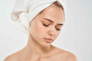 mulher com toalha em cabeça segurando face pele Cuidado dermatologia saúde foto