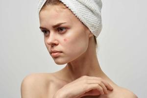 lindo mulher com uma toalha em meu cabeça dermatologia isolado fundo foto