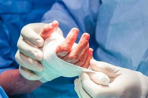 cirurgião bandagem a mão do uma paciente às a fim do cirurgia foto