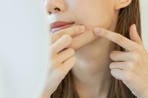 dermatologia, puberdade ásia jovem mulher, menina olhando para dentro espelho, alergia quando vestem mascarar e Cosmético, mostrar apertando espinha local para removendo a partir de rosto.beleza Cuidado a partir de pele problema de acne tratamento foto