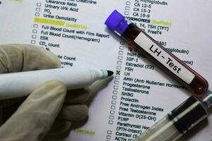 lh - teste com sangue amostra. topo Visão isolado em escritório escrivaninha. cuidados de saúde médico conceito foto