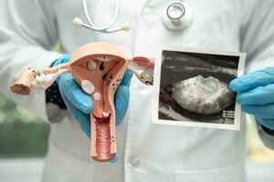 útero e ovário, médico segurando anatomia modelo e ultrassom cenário para estude diagnóstico e tratamento dentro hospital. foto