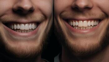 dois alegre adultos com fresco, saudável dentes e confiante sorrisos gerado de ai foto