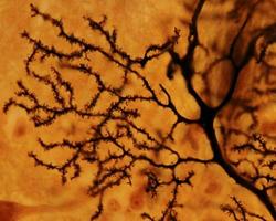 neurônio purkinje espinhas dendríticas foto
