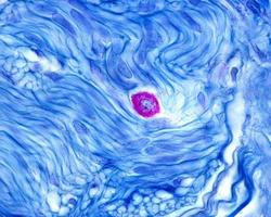 micrografia de mastócitos foto