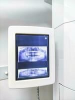 tela do dentes Varredura máquina dentro a dental clínica. foto