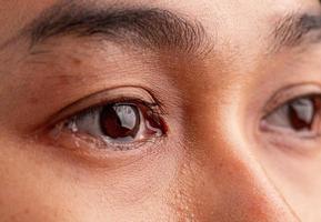 close-up de mulher asiática chorando com lágrimas e pequenas sardas em seu lindo rosto. foto