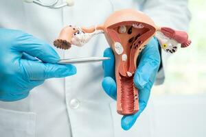 útero, médico segurando anatomia modelo para estude diagnóstico e tratamento dentro hospital. foto
