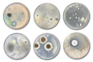 bactéria em placa de ágar isolada do ar foto