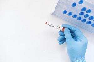 vista superior da mão com luvas médicas azuis segurando um tubo de teste de sangue com espaço de cópia foto