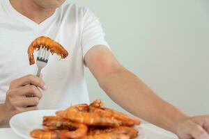 Comida alergias, homens ter reações comichão e vermelhidão depois de comendo camarão, frutos do mar alergia, coceira, irritação na pele, abdominal dor, diarréia, peito aperto, inconsciência, morte, forte evitar alergias foto