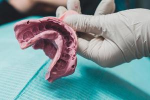 Médico ortodontista de luvas segura uma impressão digital de dentadura roxa foto