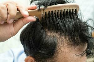 Careca às frente do cabeça e início não perda cabelo glabro do maduro ásia o negócio inteligente ativo escritório cara. foto