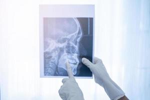 dentista segurando um raio-x odontológico foto
