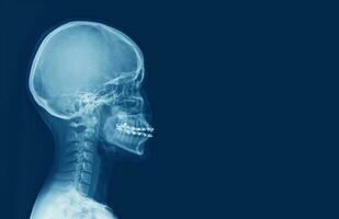 raio X do humano cervical coluna vertebral e cabeça crânio foto