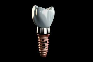 dental implantar cavidade. gerar ai foto