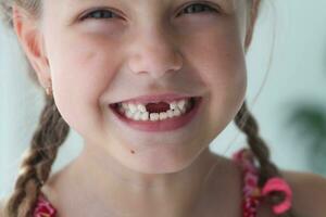 fechar-se sorrir do uma garota. uma lindo pequeno menina 6-7 anos velho tem perdido leite dentes. perda do leite dentes, substituição do permanente dentes. foto