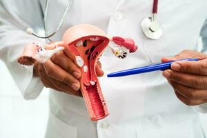 útero, médico segurando anatomia modelo para estude diagnóstico e tratamento dentro hospital. foto