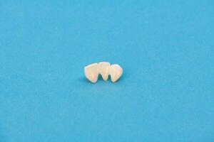 metal livre cerâmico dentes implantar dental coroas isolado em uma azul fundo. foto