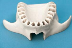 superior humano mandíbula sem dentes modelo médico implantar isolado em azul fundo. saudável dentes, dental Cuidado e ortodôntico conceito. foto