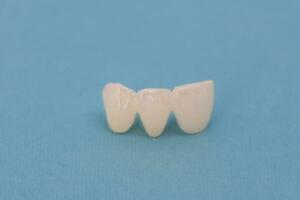 metal livre cerâmico dentes implantar dental coroas isolado em uma azul fundo. foto