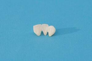 metal livre cerâmico dentes implantar dental coroas isolado em uma azul fundo. foto