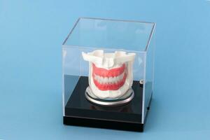 humano mandíbula com dentes implantes anatomia modelo isolado em azul fundo dentro uma vidro caixa. foto