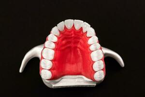 dentes implantar e coroa instalação processo partes isolado em uma azul fundo. medicamente preciso 3d modelo. foto