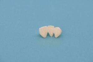 metal livre cerâmico dentes implantar dental coroas isolado em uma azul fundo. foto