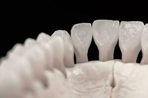 mais baixo humano mandíbula com dentes anatomia modelo isolado em Preto fundo. saudável dentes, dental Cuidado e ortodôntico médico conceito. foto