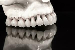 superior humano mandíbula com uma reflexão em a vidro anatomia modelo solado em azul fundo. saudável dentes, dental Cuidado e ortodôntico médico conceito. foto