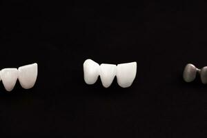 dentes implantar e coroa instalação processo partes isolado em uma Preto fundo. medicamente preciso 3d modelo. foto