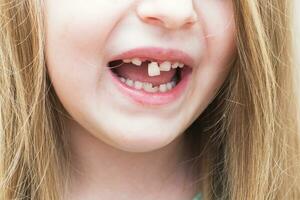 retrato do uma pequeno criança menina comovente dela leite frente dente com dela língua dentro aberto boca. foto