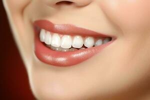 perfeito saudável dentes sorrir do uma jovem mulher às uma dentista. dentes branqueamento. dental Cuidado, estomatologia conceito de ai gerado foto