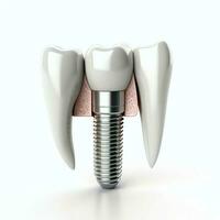fechar acima do uma dental dente implantar ou saudável humano dentes. branco esmalte e dental implantes cirurgia conceito de ai gerado foto