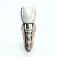 fechar acima do uma dental dente implantar ou saudável humano dentes. branco esmalte e dental implantes cirurgia conceito de ai gerado foto