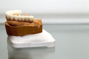 Placa dentária de porcelana de zircônio em loja de dentista foto
