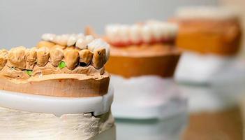 Placa dentária de porcelana de zircônio em loja de dentista foto